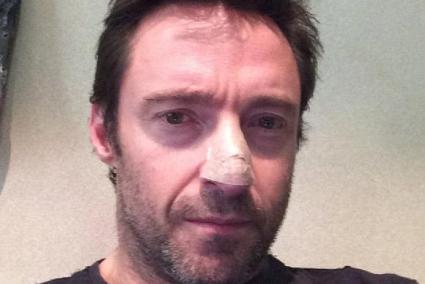 Hugh Jackman