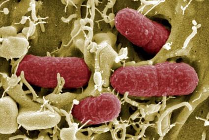 Imagen tomada mediante un telescopio electrónico de una bacteria EHEC, una cepa de la bacteria Escherichia coli de alta resisten