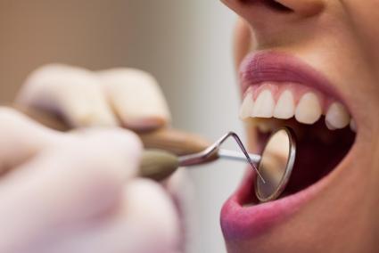 ¿Pueden las caries afectar a los pulmones?